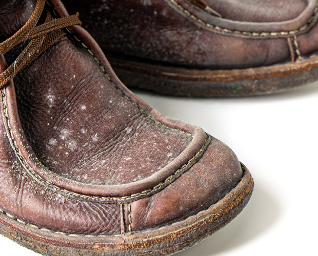 Mold growth on shoes stored in a dark, low-airflow closet